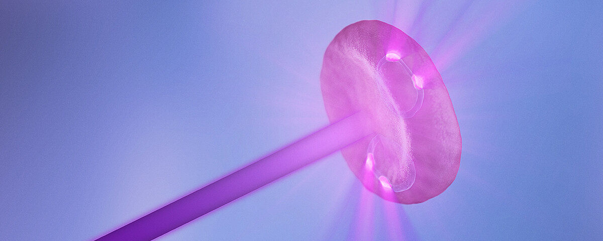 A malaria infested red blood cell being hit the by the purple laser beam of XN-31, the laser incited the stained chromatin residues of the malaria to shine.